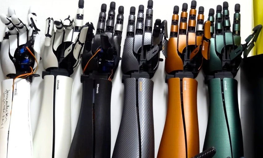 3D printed prosthetic robotic arm